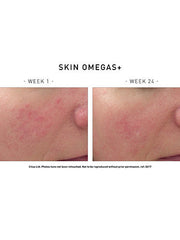 Load image into Gallery viewer, Skin Omegas+ 180 Capsules - Advanced Nutrition - Totally Refreshed Steam and Spa