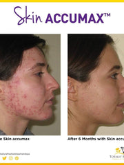 Load image into Gallery viewer, Skin Accumax 180 Capsules - Advanced Nutrition - Totally Refreshed Steam and Spa