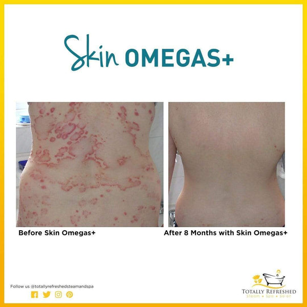 Skin Omegas+ 180 Capsules - Advanced Nutrition - Totally Refreshed Steam and Spa