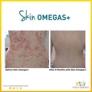 Skin Omegas+ 180 Capsules - Advanced Nutrition - Totally Refreshed Steam and Spa