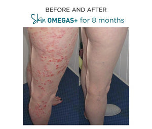 Skin Omegas+ 60 Capsules - Advanced Nutrition - Totally Refreshed Steam and Spa